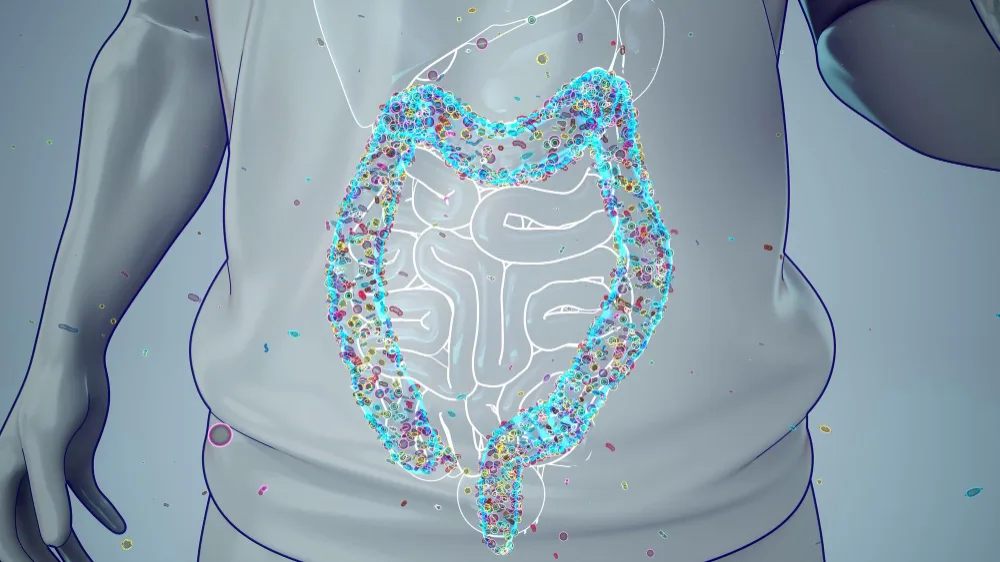 Tratamiento para síndrome de intestino irritable / colitis nerviosa en CDMX